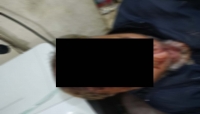 গোলাপগঞ্জে প্রতিপক্ষের হামলায় ১ জন গুরুতর 